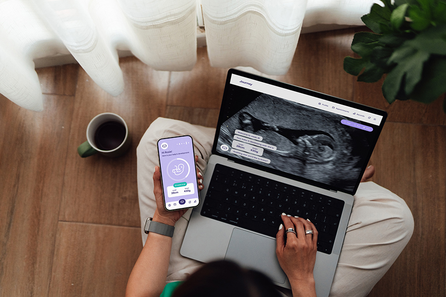 person using laptop to view sonogram