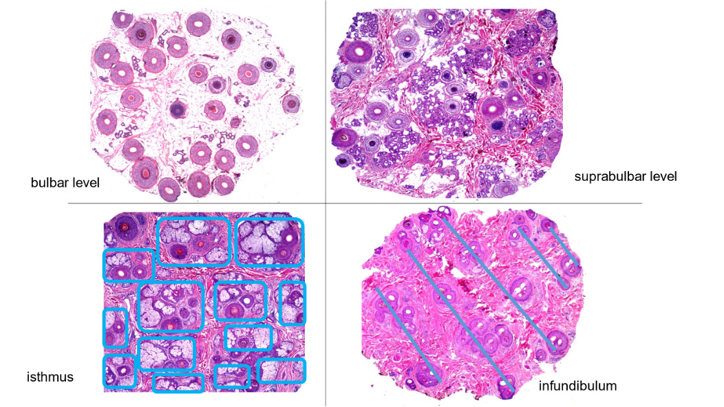 hair pathology grid of advanced imageing