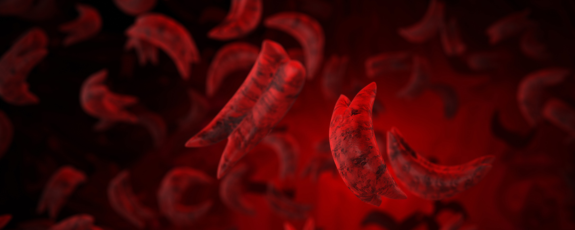 Sickle cell disease medical concept 