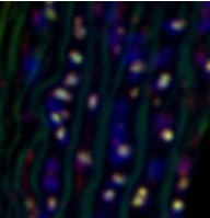 mouse aorta
