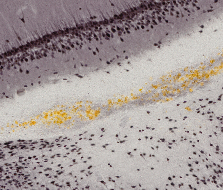 mouse brain