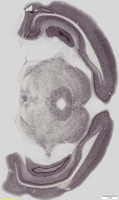 mouse brain