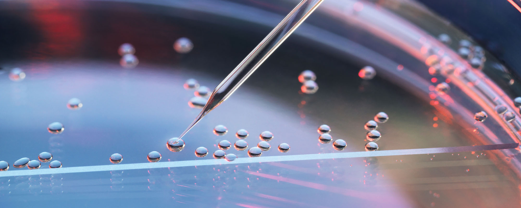 Illustration of stem cell transplant